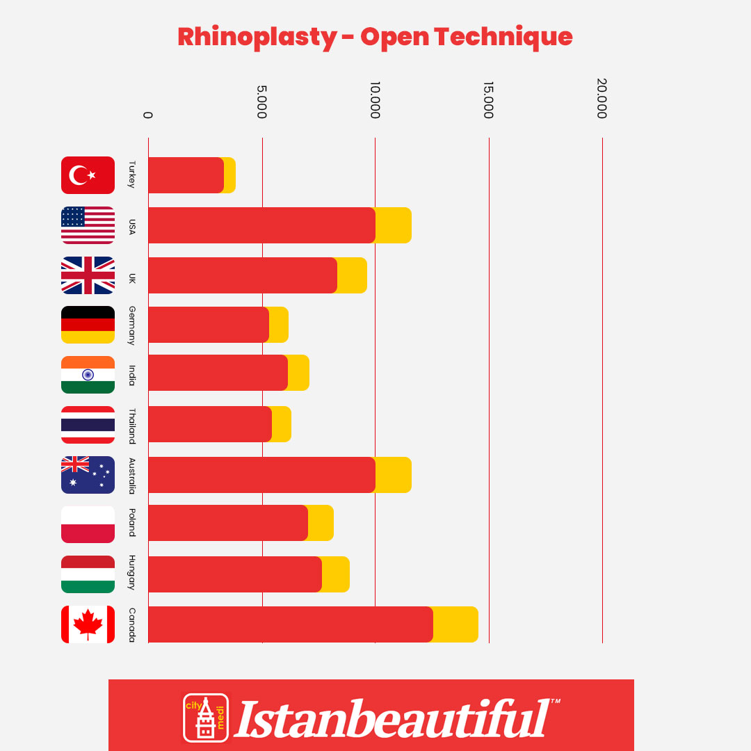 Open Rhinoplasy price comparison chart by top countries