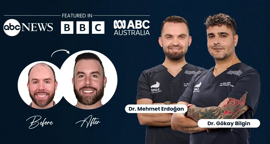 smile hair clinic istanbul turkey